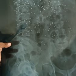 456294532_122171766272147223_1664379160936989477_n